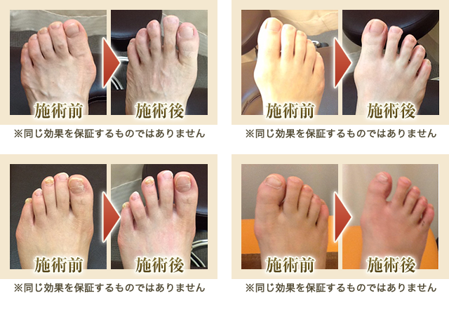 改善実績の写真