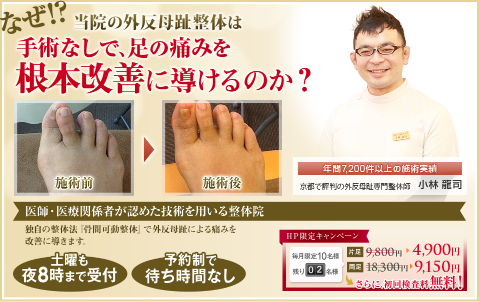 なぜ！？当院の外反母趾整体により長年悩んだ足の痛みを手術なしで根本的に改善できるのか？